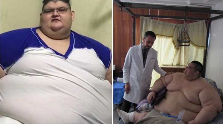 hombre mas gordo del mundo 28032017r18