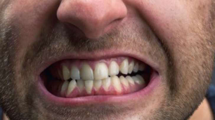 RechinadoDeDientes