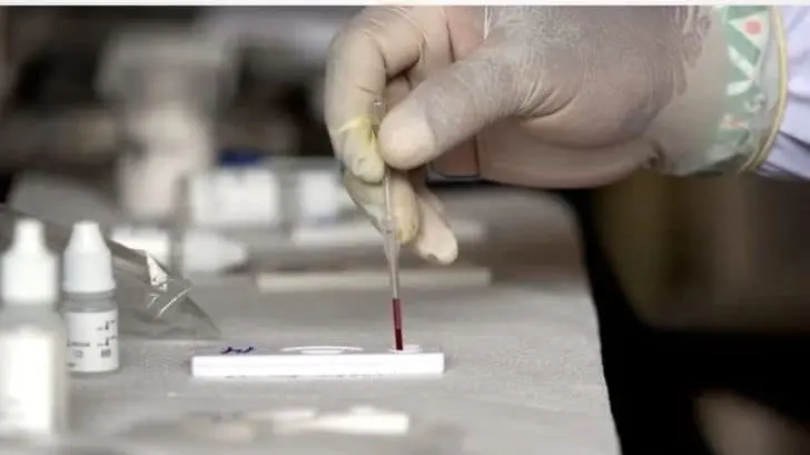 Detectan posible relación de hepatitis y Covid