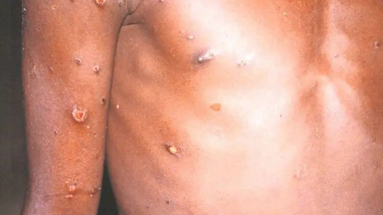 El Universal/EXPRESO