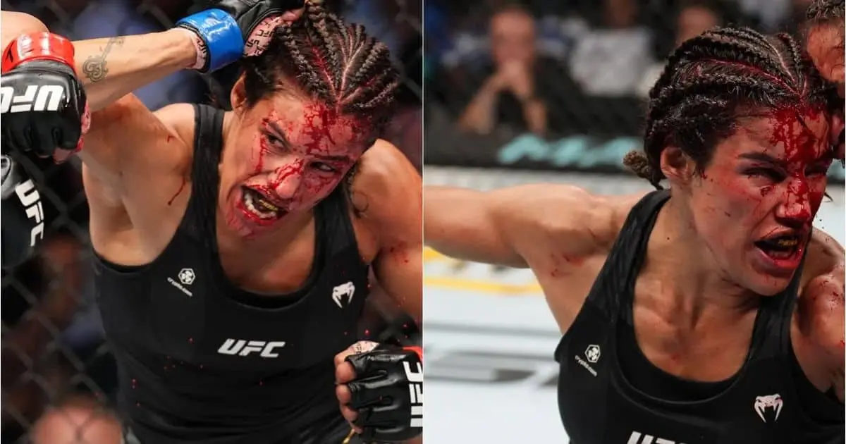 Peleadora pierde trozo de la frente en combate de UFC