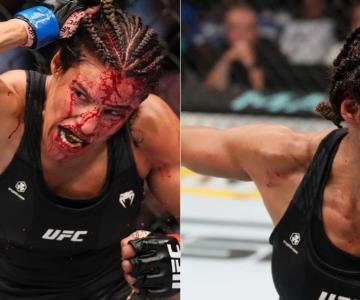 Peleadora pierde trozo de la frente en combate de UFC