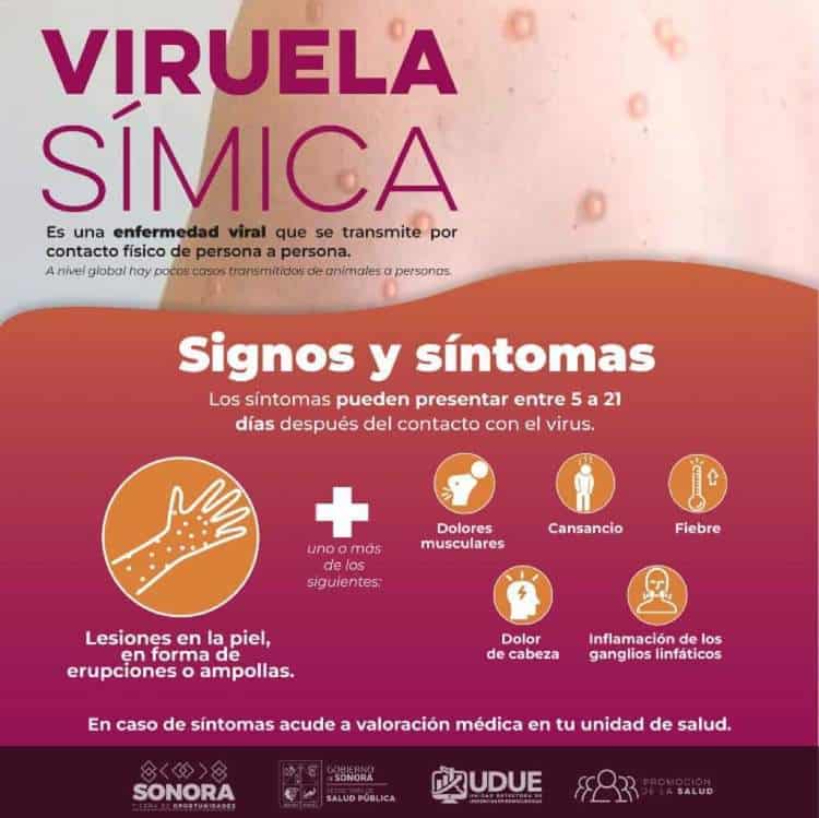 Primer caso de Viruela del Mono en Hermosillo, confirma Salud Sonora