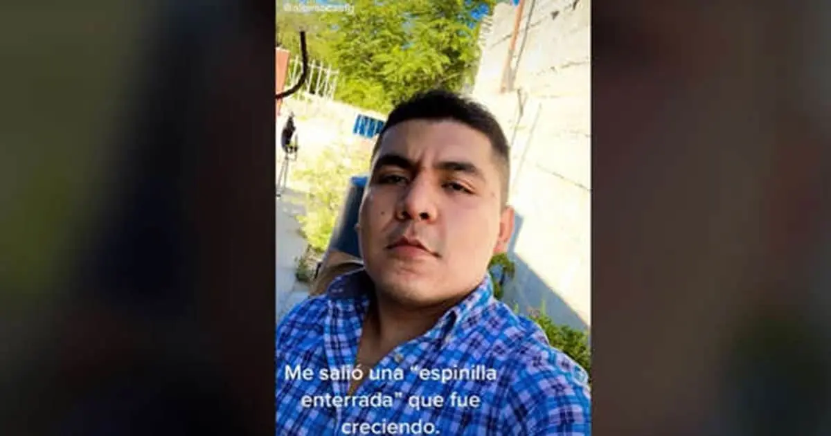 Pensaba que era un barro y terminó siendo un tumor