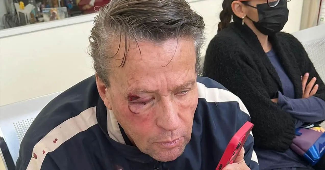 Tunden a Alfredo Adame en redes tras ser agredido en Tlalpan