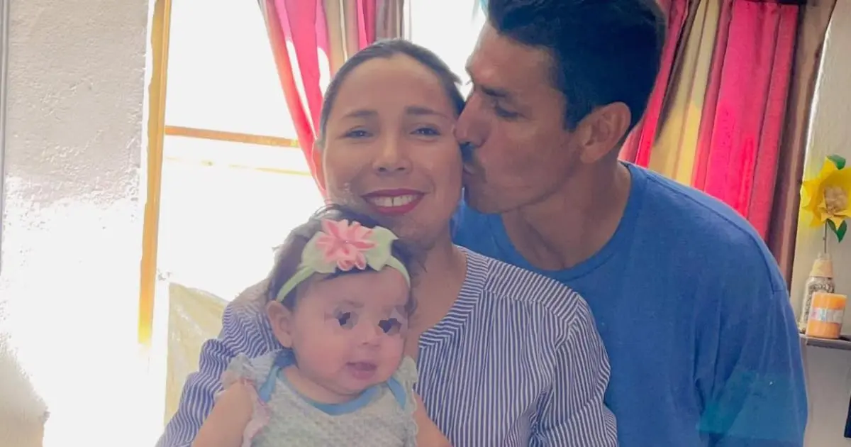 Perla solicita apoyo para retirar un tumor cerebral