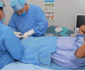 Realizarán jornada especial por el Día Mundial de la Vasectomía sin Bisturí