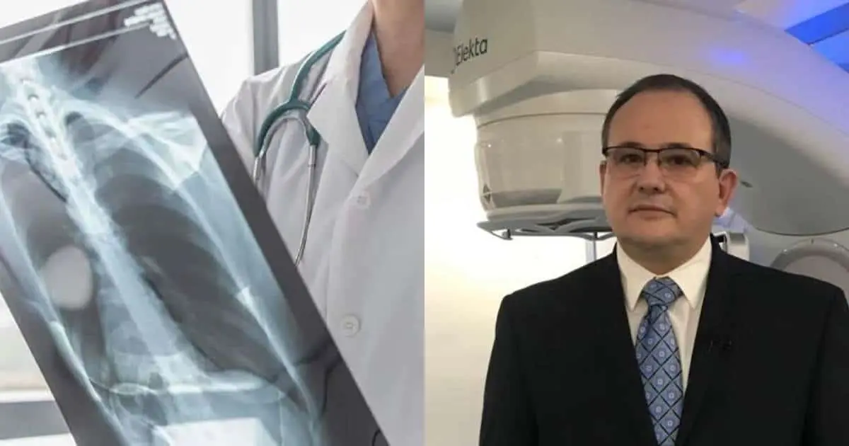 Es cáncer pulmonar el de más mortalidad
