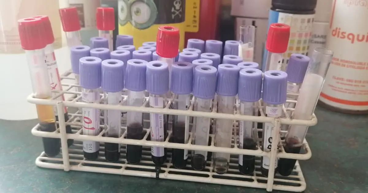 Realiza Cruz Roja Obregón pruebas de dengue por 300 pesos