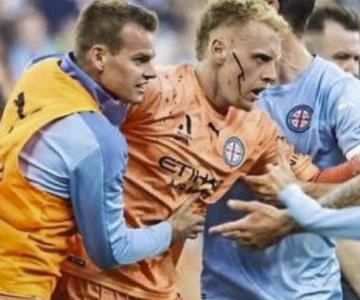 Agreden a portero de Melbourne City en partido de futbol Australia