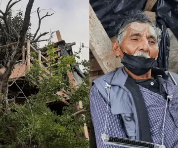 Una infección en el pie impide a Don Manuel trabajar para subsistir
