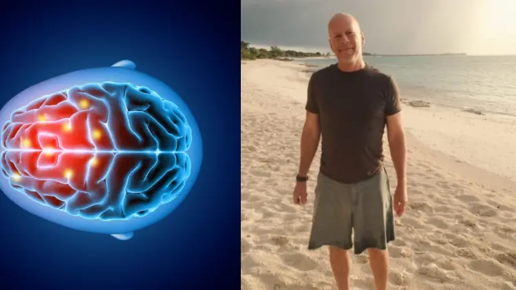 Bruce Willis sufre demencia frontotemporal. (Foto: Especial/EXPRESO)