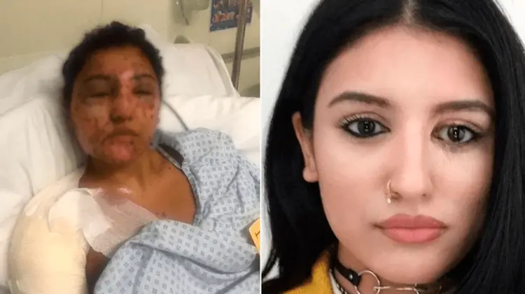 Ataque de ácido en mujer (Foto: Ilustrativa / EXPRESO)