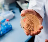 Detectan peligroso hongo en cerebro de paciente en Emiratos Árabes Unidos