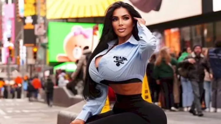 Muere modelo de OnlyFans tras cirugía para parecerse a Kim Kardashian