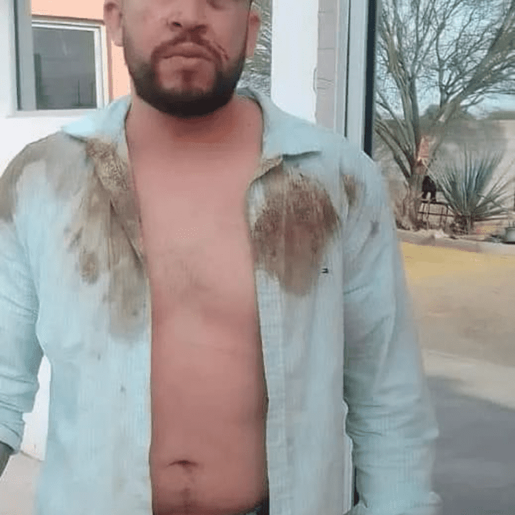 Hasta balazos me tiraron: denuncia presunto abuso policial en San Pedro