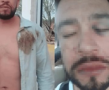 Hasta balazos me tiraron: denuncia presunto abuso policial en San Pedro