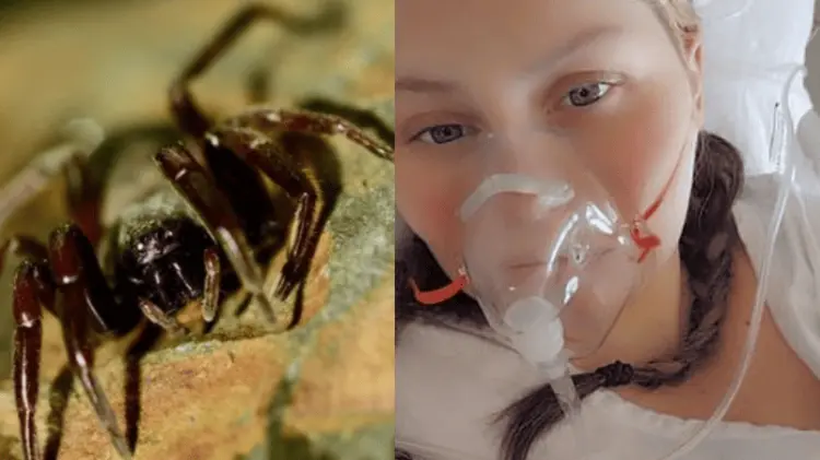 Mujer sufre picadura de araña. (Foto: Redes / EXPRESO)