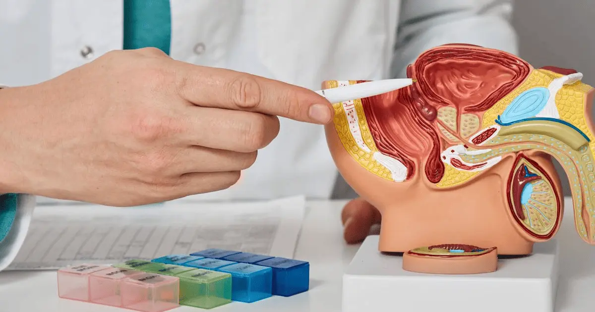 Cuídate: estos son los síntomas del cáncer de próstata