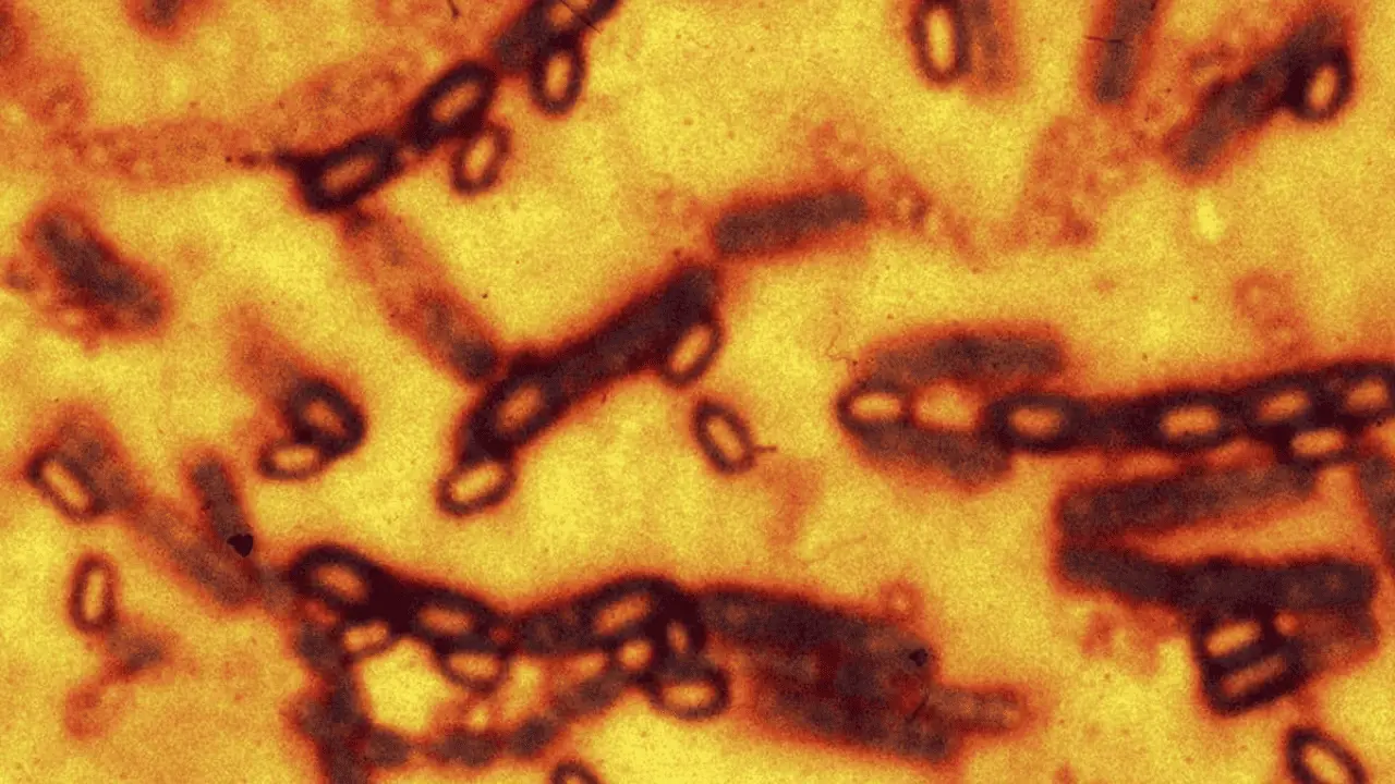 Detectan en China virus con potencial pandémico similares al mortal Nipah
