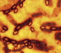 Detectan en China virus con potencial pandémico similares al mortal Nipah