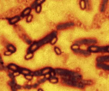 Detectan en China virus con potencial pandémico similares al mortal Nipah