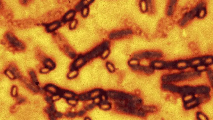 Enfermedad infecciosa causada por la bacteria Bacillus anthracis. (Foto: Especial / EXPRESO)