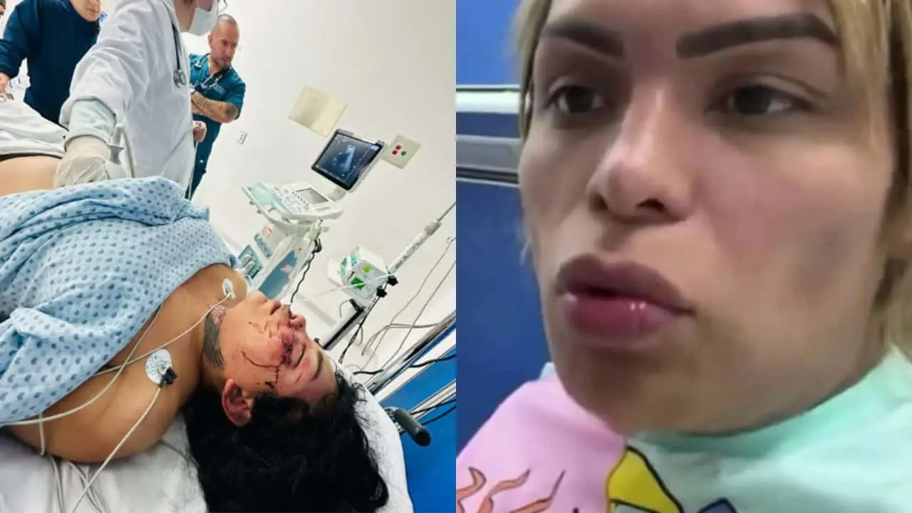 Wendy Guevara denunció la agresión a Paola Suárez como Patadas y un robo