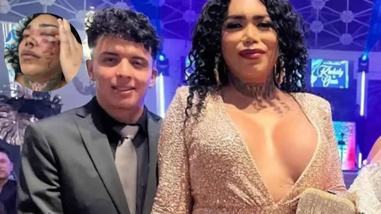 Paola Suárez no perdera el ojo gracias a la atención medica