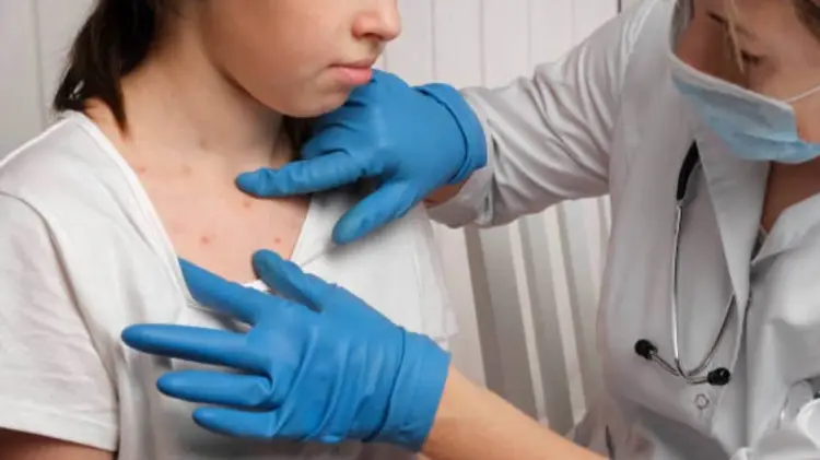 La infección de sarampión se considera altamente contagiosa. (Foto: Especial)