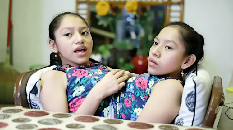 En una cirugía de seis horas, médicos les retiraron una tercera pierna. (Foto: Especial / EXPRESO).