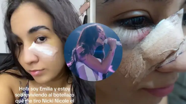 La herida de Emilia requirió de cinco puntos de sutura, según comentó. (Fotos: Capturas de video)