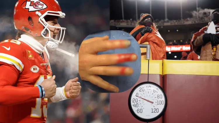 Algunos afectados requirieron amputaciones dos meses después del juego. (Foto: Cortesía)