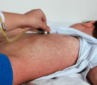 Reporta Secretaría de Salud mil 926 casos de sarampión en México