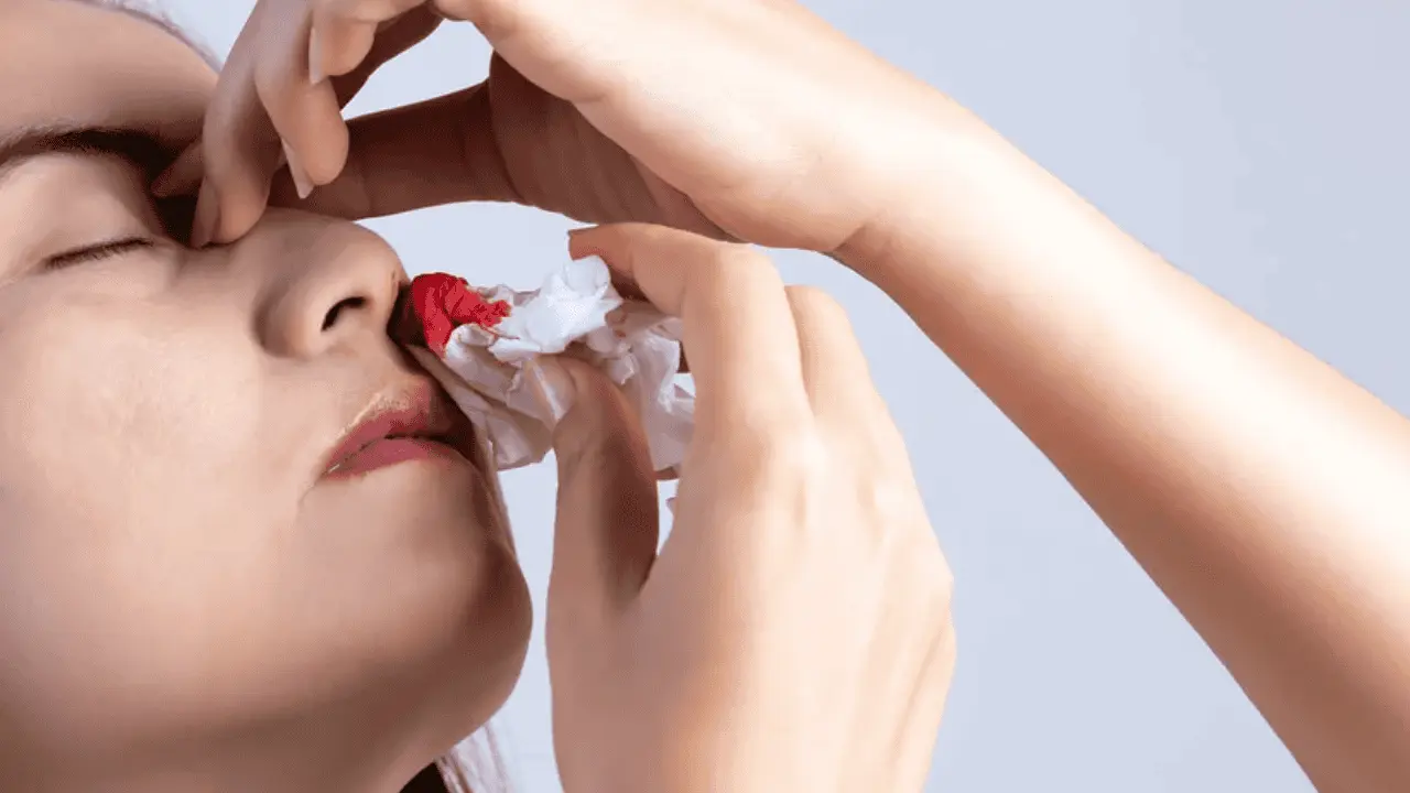 Esta es la razón del sangrado nasal durante las altas temperaturas