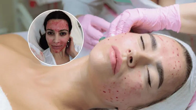 Kim Kardashian es una de las famosas que se ha sometido a este popular tratamiento. (Foto: Especial)