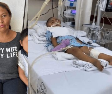Niña atropellada en Navojoa necesita ayuda con gastos médicos