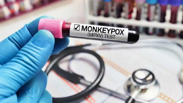 Foto: Especial / EXPRESO.