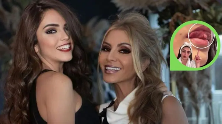 La joven no desea aún operarse para erradicar el problema.