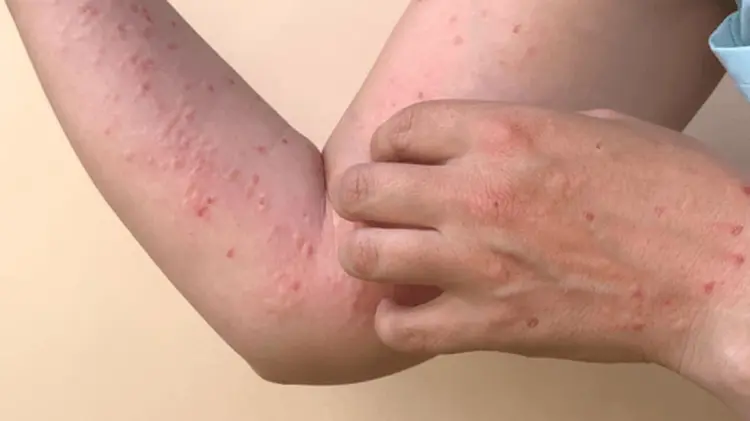 Foto: Especial / EXPRESO.