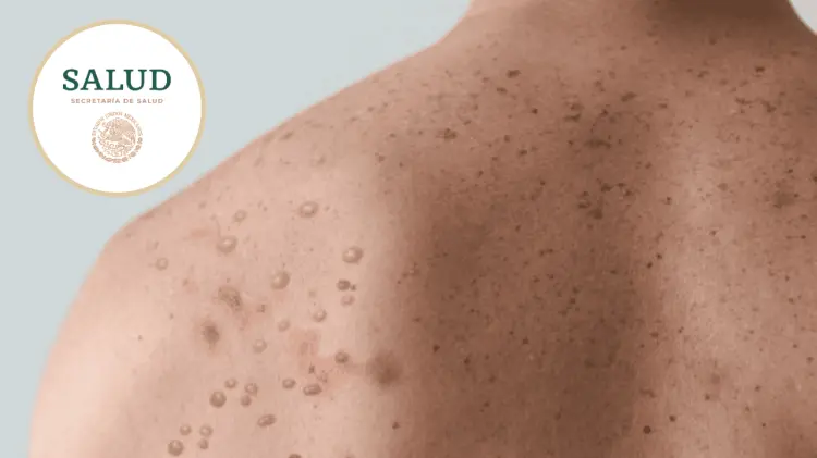 El riesgo pasó de bajo a medio este miércoles por la mañana. (Especial / EXPRESO)