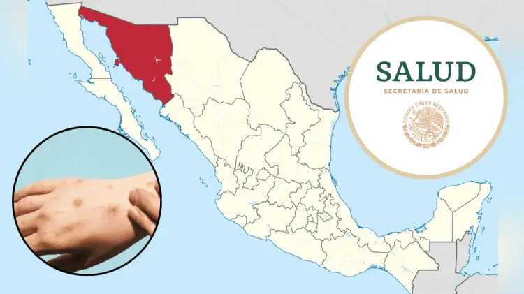 Sonora fue el único estado que ingresó a la lista de Estados confirmados con Mpox. (Foto: Especial)