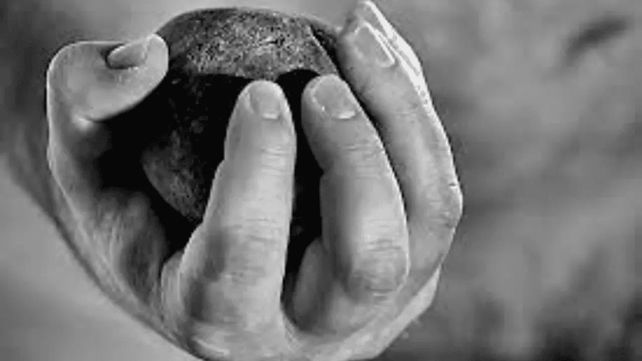 Hombre sufre traumatismo craneoencefálico tras ser agredido con una piedra
