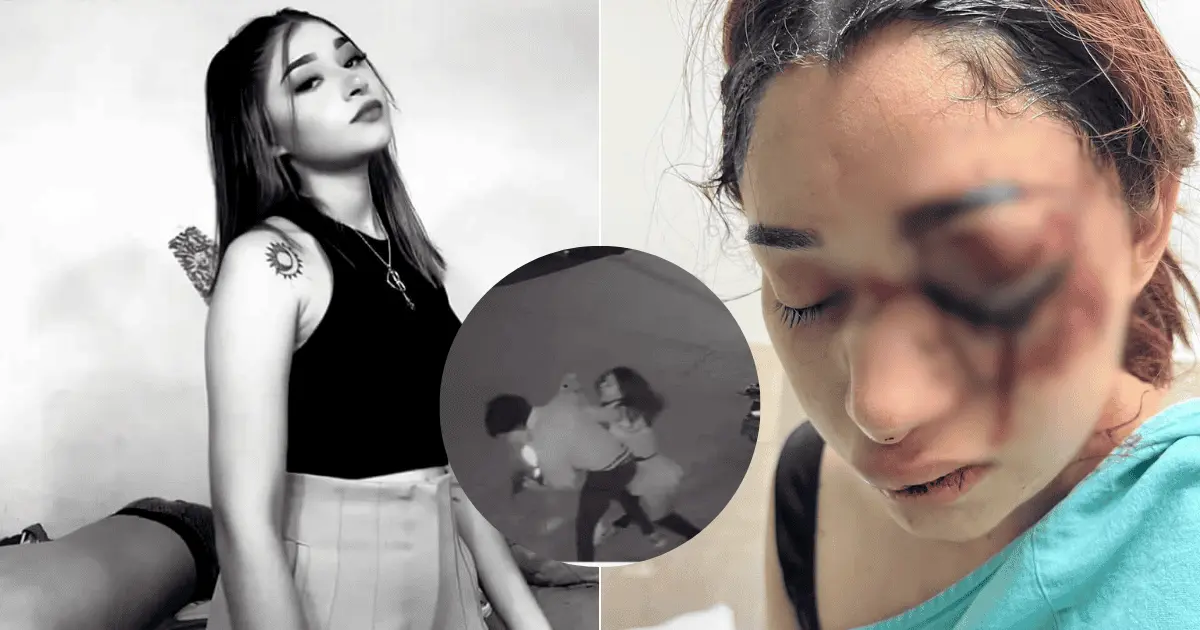 Melanie Barragán es dada de alta tras operación; su agresor sigue prófugo
