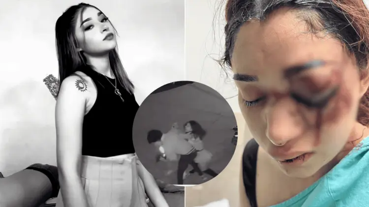 El IMSS Tamaulipas informó que Melanie ya descansa en su casa tras la operación. (Foto: Especial)