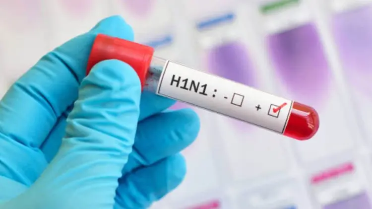 La Secretaría de Salud hizo un llamado a la prevención. (Foto: Especial)