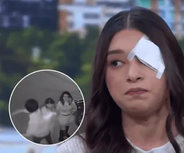 Tiktoker ayuda con cirugía de ojo a Melanie, joven golpeada por su novio