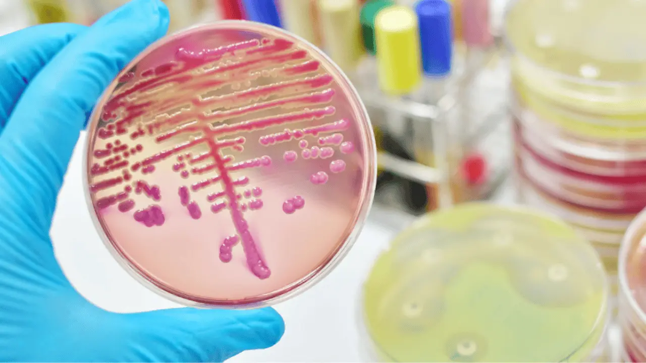 Advierten riesgos para los menores por bacteria Klebsiella oxytoca