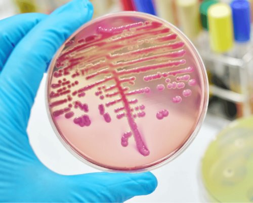 Advierten riesgos para los menores por bacteria Klebsiella oxytoca