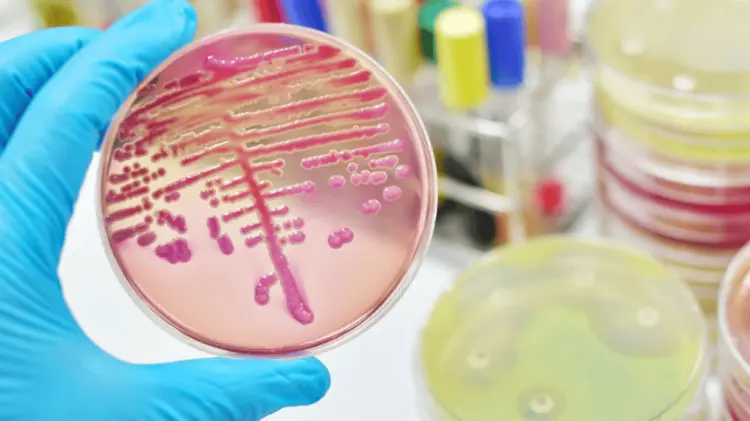 Complicaciones por esta bacteria se registran en pacientes hospitalizados. (Foto: Ilustrativa)